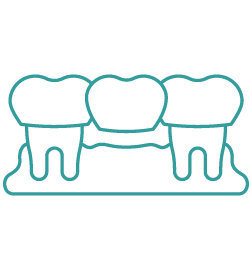 Dental Bridges 